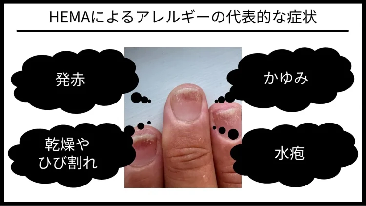 HEMAによるアレルギーの代表的な症状を解説する図