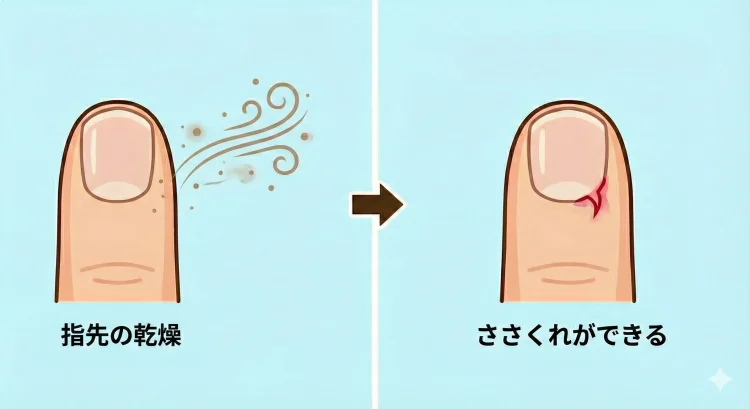 乾燥がささくれにつながる