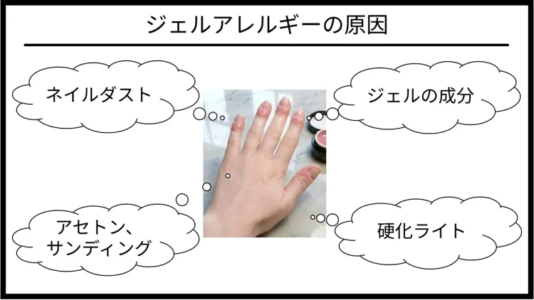 ジェルアレルギーの原因を解説します