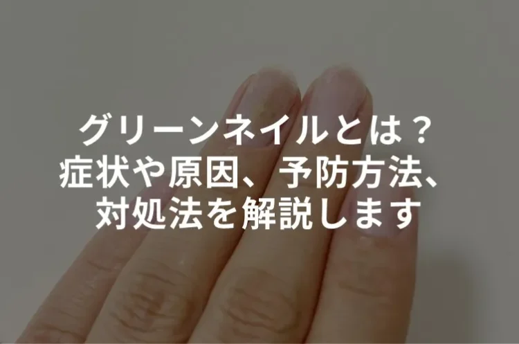 グリーンネイルとは？症状や原因、予防方法、対処法をわかりやすく解説します